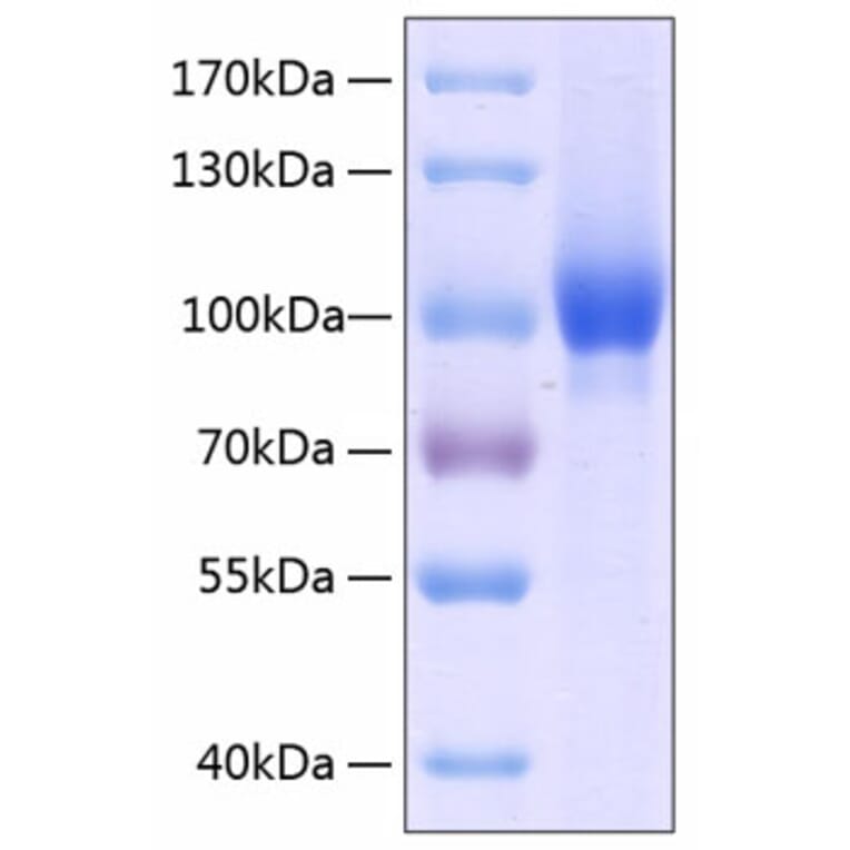 SDS-PAGE - Recombinant Human Neuropilin-1 Protein (C-terminal His Tag) (A331097) - Antibodies.com