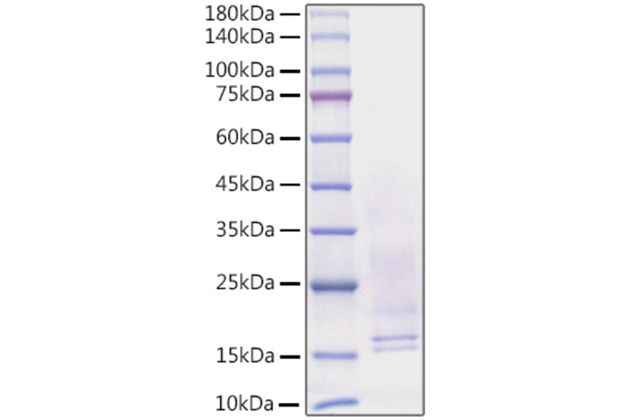 SDS-PAGE - Recombinant Human NGF Protein (C-terminal His Tag) (A331100) - Antibodies.com