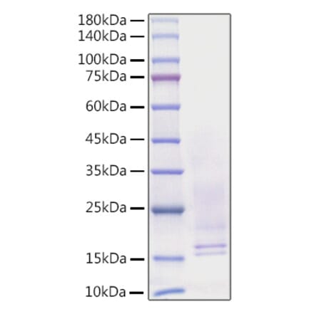 SDS-PAGE - Recombinant Human NGF Protein (C-terminal His Tag) (A331100) - Antibodies.com