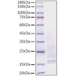 SDS-PAGE - Recombinant Human NGF Protein (C-terminal His Tag) (A331100) - Antibodies.com