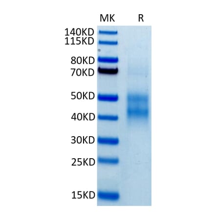 Tris-Bis PAGE - Recombinant Human NKG2A Protein (Biotin) (N-terminal His and Avi Tag) (A331101) - Antibodies.com