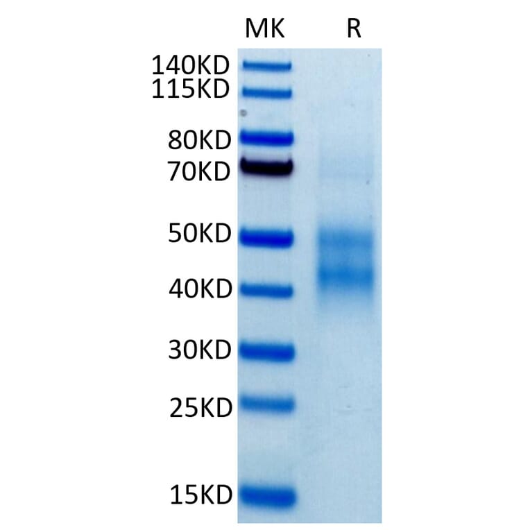 Tris-Bis PAGE - Recombinant Human NKG2A Protein (Biotin) (N-terminal His and Avi Tag) (A331101) - Antibodies.com