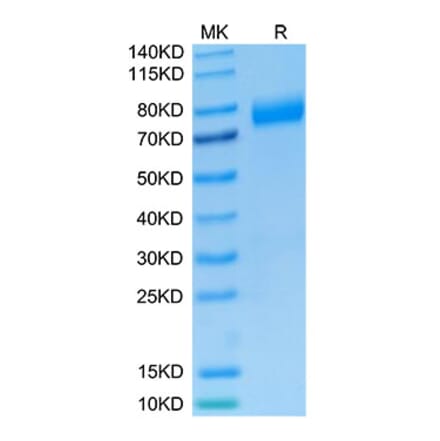 Tris-Bis PAGE - Recombinant Human NKG2A + CD94 Protein (C-terminal Mouse Fc Tag) (A331102) - Antibodies.com