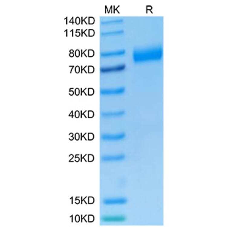 Tris-Bis PAGE - Recombinant Human NKG2A + CD94 Protein (C-terminal Mouse Fc Tag) (A331102) - Antibodies.com