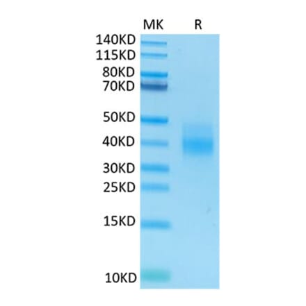 Tris-Bis PAGE - Recombinant Human NKG2A + CD94 Protein (N-terminal His and Avi Tag) (A331103) - Antibodies.com