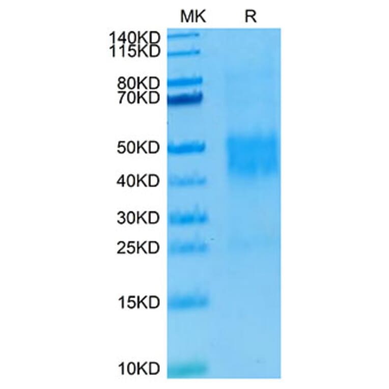 Tris-Bis PAGE - Recombinant Human NKG2C Protein (N-terminal His and Avi Tag) (A331105) - Antibodies.com