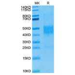 Tris-Bis PAGE - Recombinant Human NKG2C Protein (N-terminal His and Avi Tag) (A331105) - Antibodies.com