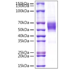 SDS-PAGE - Recombinant Human NKG2D Protein (N-terminal Rabbit Fc Tag) (A331106) - Antibodies.com