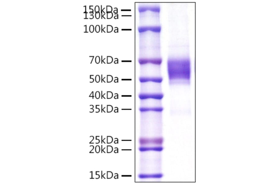 SDS-PAGE - Recombinant Human NKG2D Protein (N-terminal Rabbit Fc Tag) (A331106) - Antibodies.com