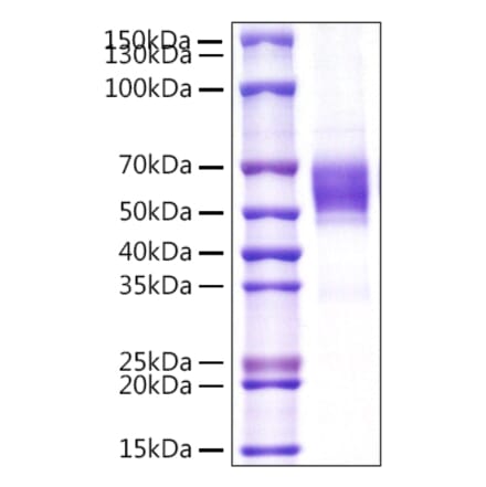 SDS-PAGE - Recombinant Human NKG2D Protein (N-terminal Rabbit Fc Tag) (A331106) - Antibodies.com