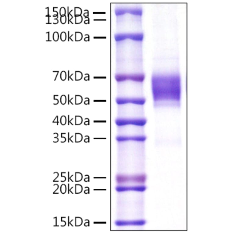 SDS-PAGE - Recombinant Human NKG2D Protein (N-terminal Rabbit Fc Tag) (A331106) - Antibodies.com