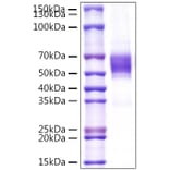 SDS-PAGE - Recombinant Human NKG2D Protein (N-terminal Rabbit Fc Tag) (A331106) - Antibodies.com