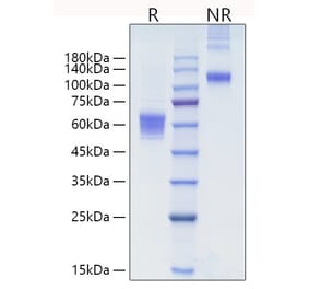 SDS-PAGE - Recombinant human NKG2D Protein (N-terminal Human Fc Tag) (A331107) - Antibodies.com