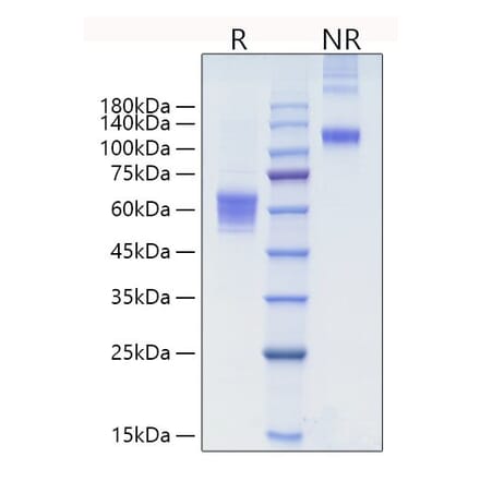 SDS-PAGE - Recombinant human NKG2D Protein (N-terminal Human Fc Tag) (A331107) - Antibodies.com