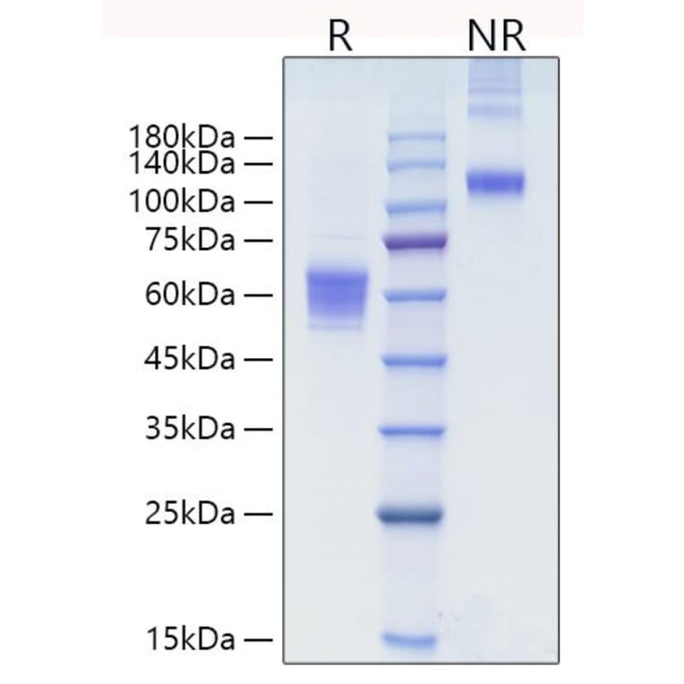 SDS-PAGE - Recombinant human NKG2D Protein (N-terminal Human Fc Tag) (A331107) - Antibodies.com