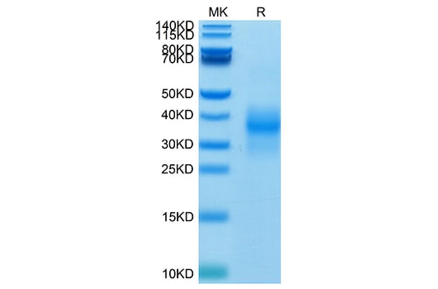 Tris-Bis PAGE - Recombinant Human NKG2D Protein (Biotin) (N-terminal His and Avi Tag) (A331108) - Antibodies.com