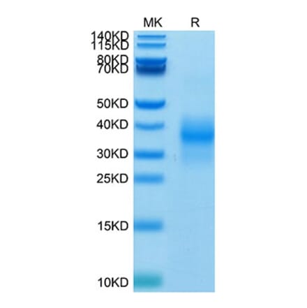 Tris-Bis PAGE - Recombinant Human NKG2D Protein (Biotin) (N-terminal His and Avi Tag) (A331108) - Antibodies.com