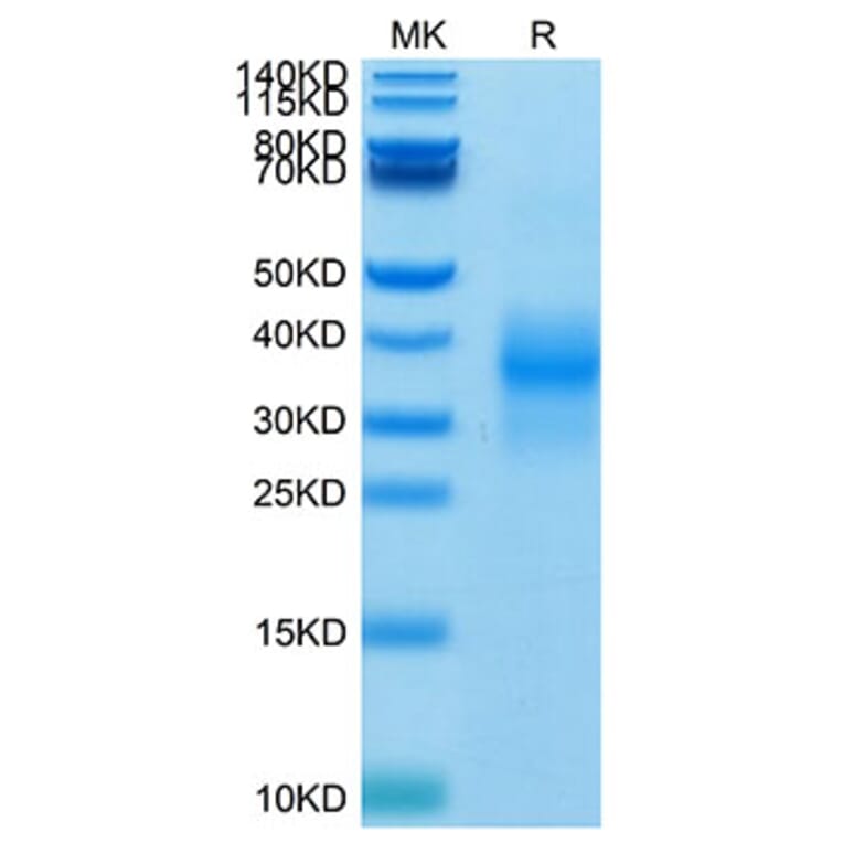 Tris-Bis PAGE - Recombinant Human NKG2D Protein (Biotin) (N-terminal His and Avi Tag) (A331108) - Antibodies.com