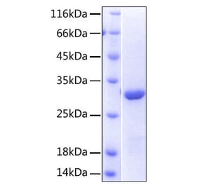 SDS-PAGE - Recombinant Human NKG2D Protein (N-terminal His Tag) (A331109) - Antibodies.com