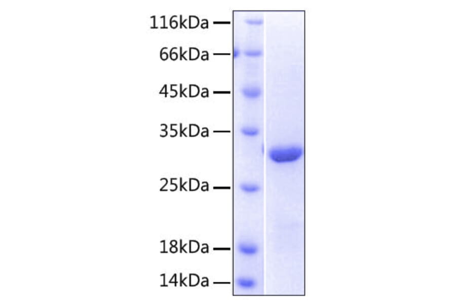 SDS-PAGE - Recombinant Human NKG2D Protein (N-terminal His Tag) (A331109) - Antibodies.com