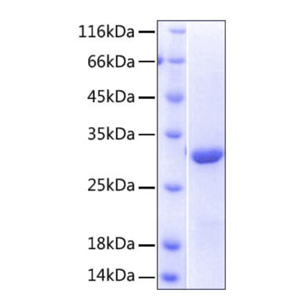 SDS-PAGE - Recombinant Human NKG2D Protein (N-terminal His Tag) (A331109) - Antibodies.com