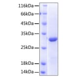 SDS-PAGE - Recombinant Human NKG2D Protein (N-terminal His Tag) (A331109) - Antibodies.com