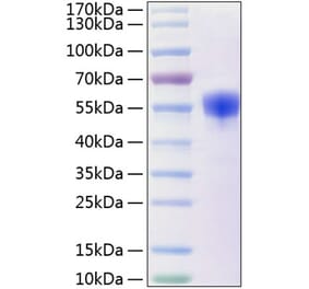 SDS-PAGE - Recombinant Human NKp30 Protein (C-terminal Human Fc and His Tag) (A331110) - Antibodies.com