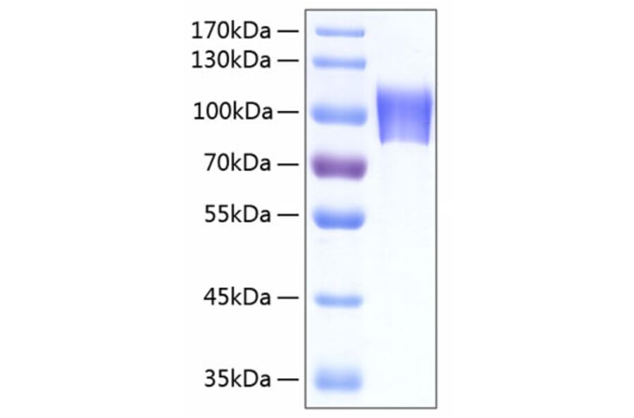 SDS-PAGE - Recombinant Human NLGN4X Protein (C-terminal His Tag) (A331111) - Antibodies.com