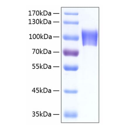 SDS-PAGE - Recombinant Human NLGN4X Protein (C-terminal His Tag) (A331111) - Antibodies.com