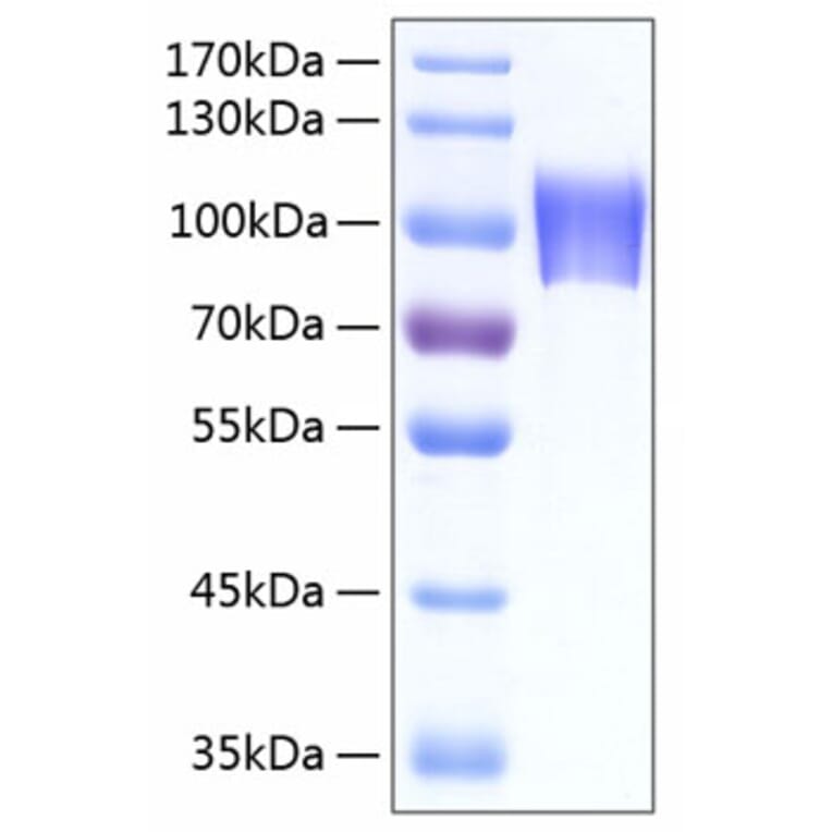 SDS-PAGE - Recombinant Human NLGN4X Protein (C-terminal His Tag) (A331111) - Antibodies.com