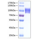 SDS-PAGE - Recombinant Human NLGN4X Protein (C-terminal His Tag) (A331111) - Antibodies.com