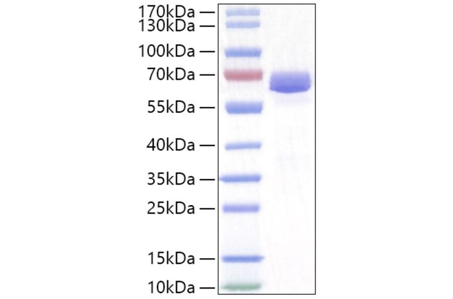 SDS-PAGE - Recombinant Human NLN Protein (N-terminal His Tag) (A331112) - Antibodies.com