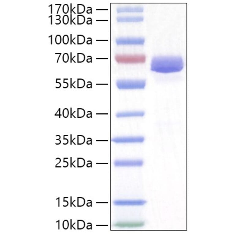SDS-PAGE - Recombinant Human NLN Protein (N-terminal His Tag) (A331112) - Antibodies.com