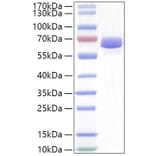 SDS-PAGE - Recombinant Human NLN Protein (N-terminal His Tag) (A331112) - Antibodies.com