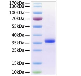 SDS-PAGE - Recombinant Human Noggin Protein (C-terminal His Tag) (A331113) - Antibodies.com