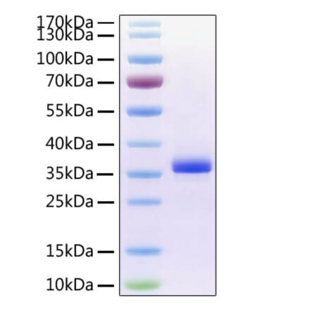 SDS-PAGE - Recombinant Human Noggin Protein (C-terminal His Tag) (A331113) - Antibodies.com