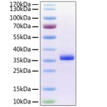 SDS-PAGE - Recombinant Human Noggin Protein (C-terminal His Tag) (A331113) - Antibodies.com