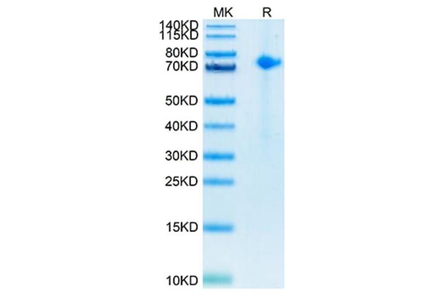 Tris-Bis PAGE - Recombinant Human Notch1 Protein (Biotin) (C-terminal His and Avi Tag) (A331114) - Antibodies.com