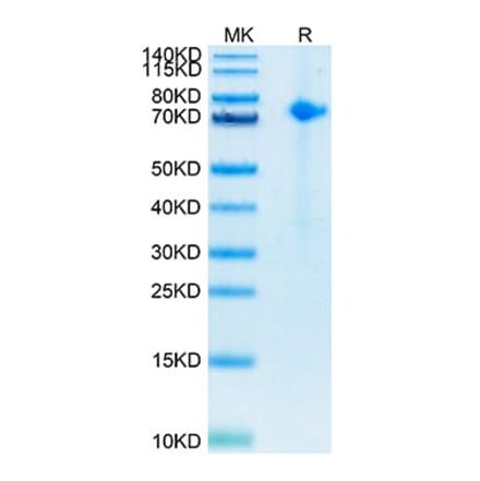 Tris-Bis PAGE - Recombinant Human Notch1 Protein (Biotin) (C-terminal His and Avi Tag) (A331114) - Antibodies.com