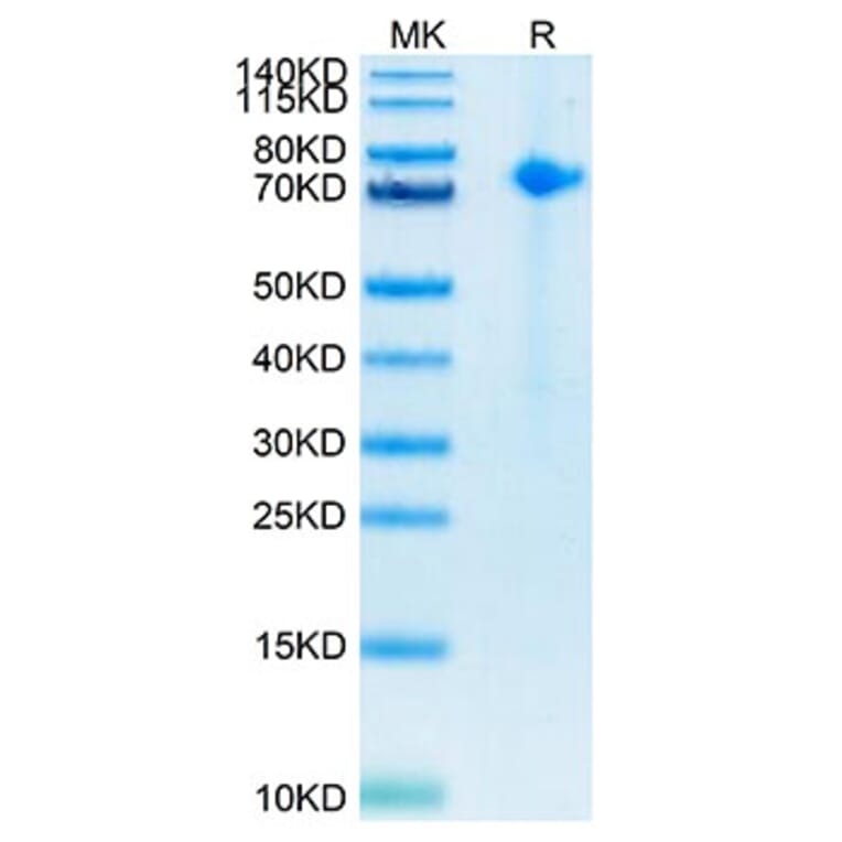 Tris-Bis PAGE - Recombinant Human Notch1 Protein (Biotin) (C-terminal His and Avi Tag) (A331114) - Antibodies.com