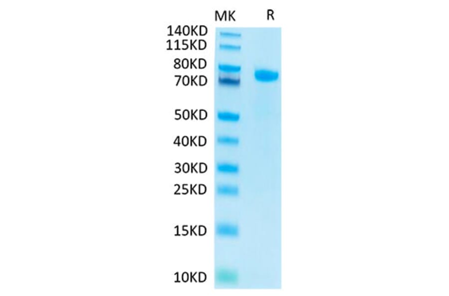 Tris-Bis PAGE - Recombinant Human Notch1 Protein (C-terminal His and Avi Tag) (A331115) - Antibodies.com