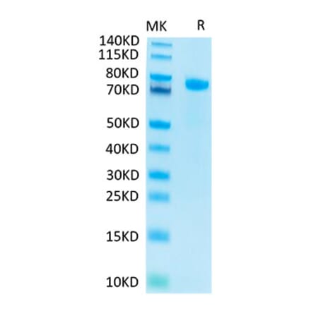 Tris-Bis PAGE - Recombinant Human Notch1 Protein (C-terminal His and Avi Tag) (A331115) - Antibodies.com