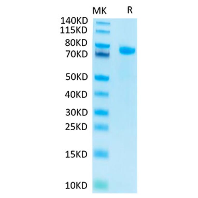 Tris-Bis PAGE - Recombinant Human Notch1 Protein (C-terminal His and Avi Tag) (A331115) - Antibodies.com