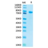 Tris-Bis PAGE - Recombinant Human Notch1 Protein (C-terminal His and Avi Tag) (A331115) - Antibodies.com