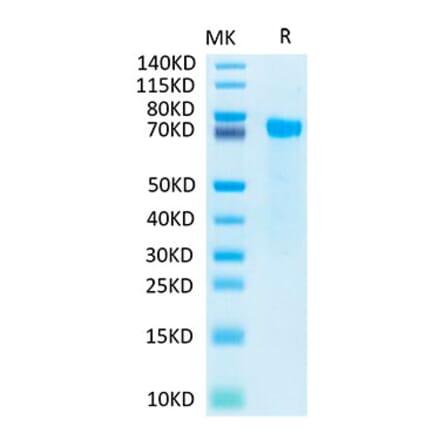 Tris-Bis PAGE - Recombinant Human Notch2 Protein (Biotin) (C-terminal His and Avi Tag) (A331116) - Antibodies.com