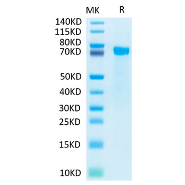 Tris-Bis PAGE - Recombinant Human Notch2 Protein (Biotin) (C-terminal His and Avi Tag) (A331116) - Antibodies.com
