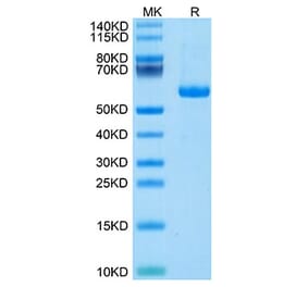 Tris-Bis PAGE - Recombinant Human Notch3 Protein (C-terminal His and Avi Tag) (A331117) - Antibodies.com
