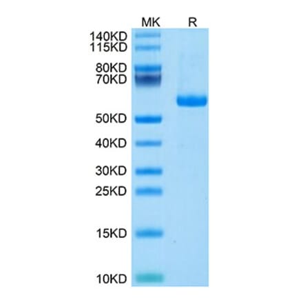 Tris-Bis PAGE - Recombinant Human Notch3 Protein (C-terminal His and Avi Tag) (A331117) - Antibodies.com