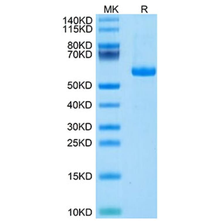 Tris-Bis PAGE - Recombinant Human Notch3 Protein (C-terminal His and Avi Tag) (A331117) - Antibodies.com