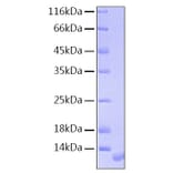 SDS-PAGE - Recombinant Human NRG1 Protein (A331118) - Antibodies.com